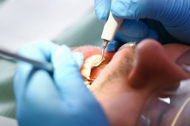 Best Weekend Emergency Dentist in South Lebanon, OH