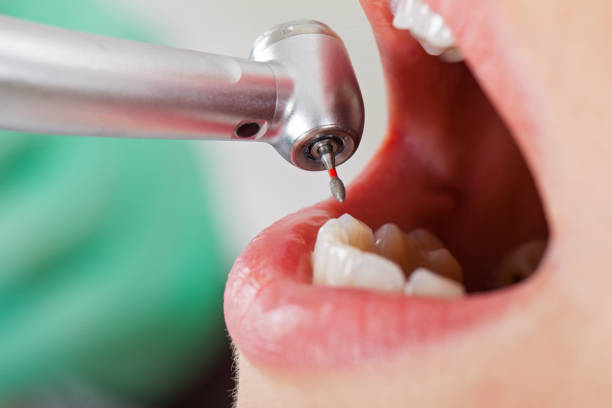 Best Emergency Dentist for Special Needs Patients in South Lebanon, OH